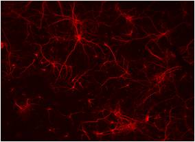 cerebral cortex.jpg
