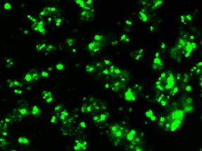 neurospheres gfp