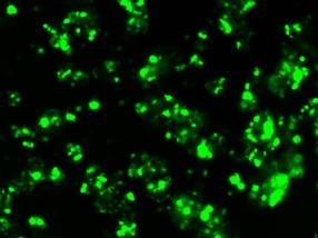 neurospheres gfp